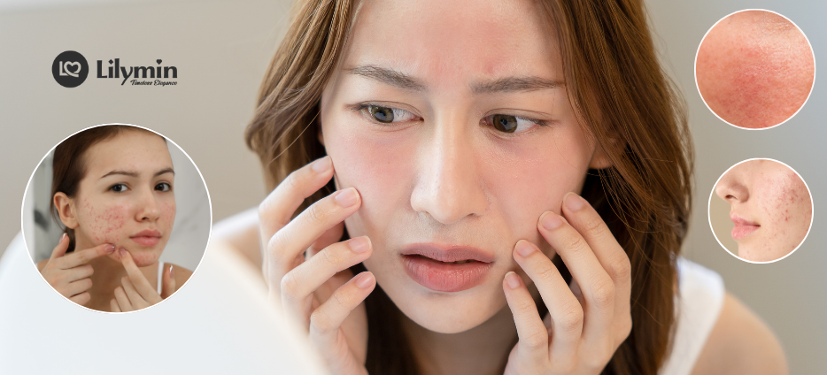 Sensitive Skincare