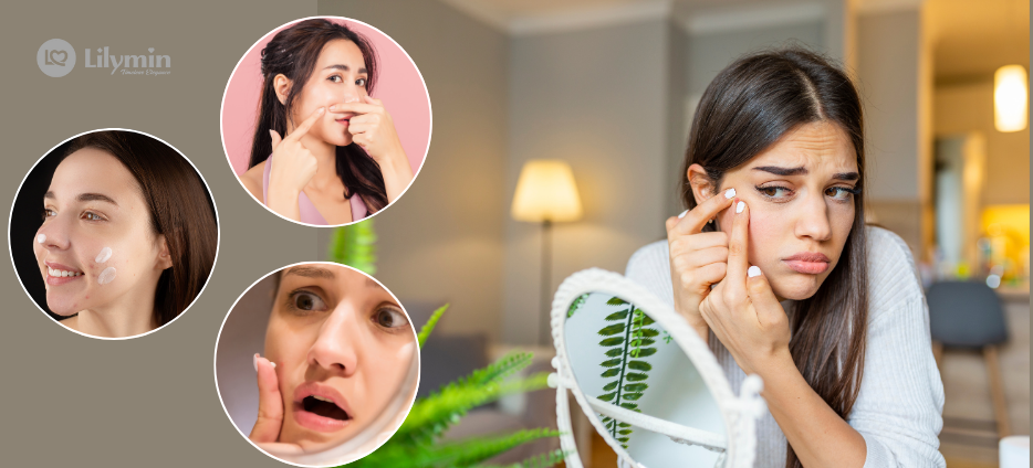 Pimple Cream